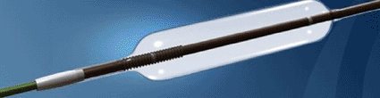Image: The GPSCath balloon dilatation catheter (photo courtesy Hotspur Technologies).
